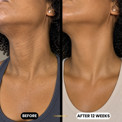 Triple Collagen Plumping Gel Neck Mask